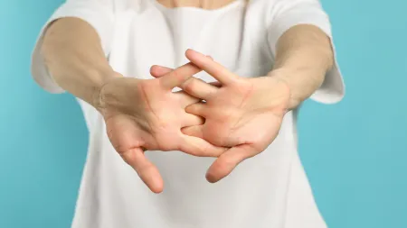 Estalar os dedos causa artrite? O que a ciência diz