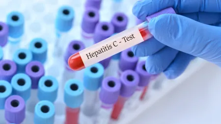 Estudos Revelam Relação entre o Vírus da Hepatite C e Distúrbios Mentais