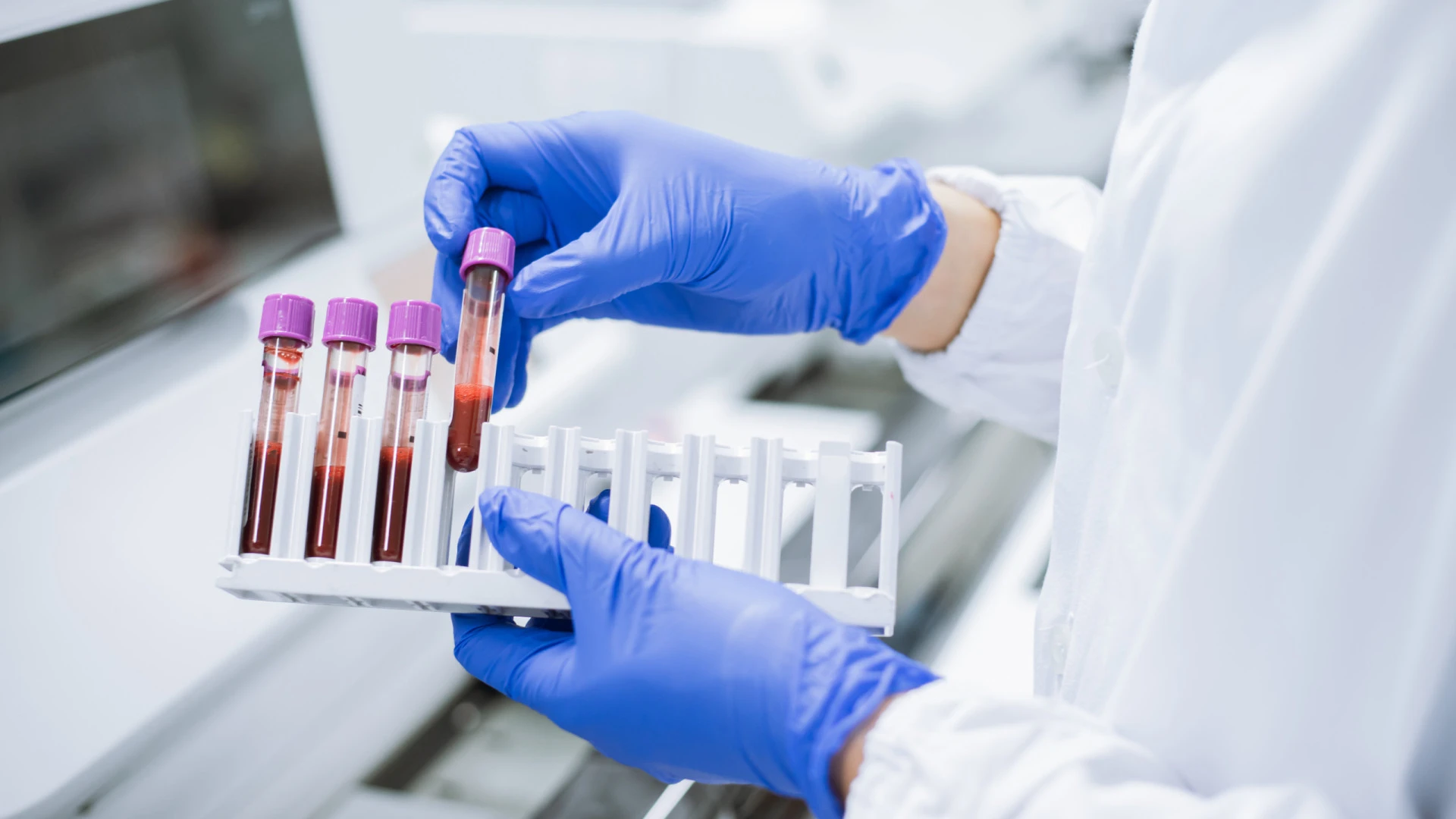 Instituto do Sangue defende campanha e responde a críticas