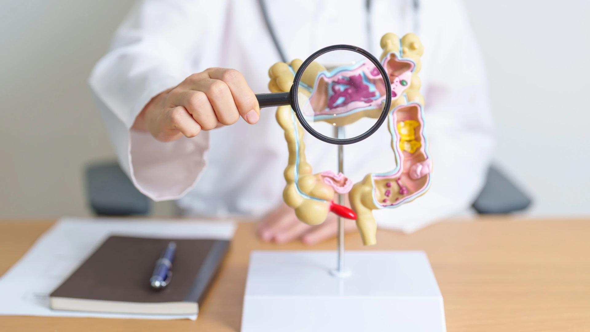 Diferenças Cruciais entre Cancro Colorretal e Síndrome do Intestino Irritável